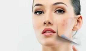 how-to-prevent-scars-on-the-face