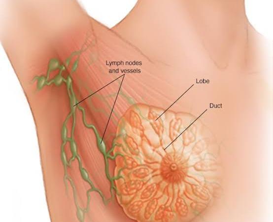 breast-cancer-problem-health-tips