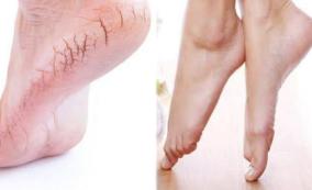 patha-vedippu-treatment-at-home-medicine