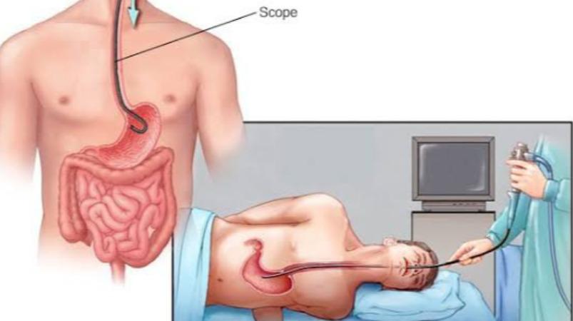 urlcer-treatment-health-tips