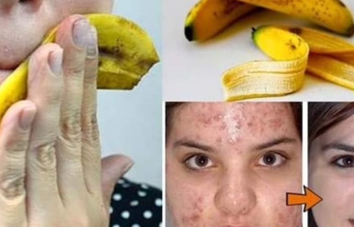 banana-skin-health-tips