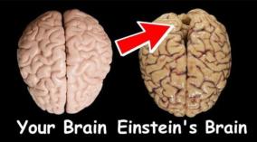 einstein-brain-news