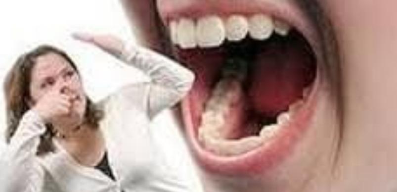mouth-smell-health-tips