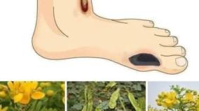 sugar-patient-health-tips