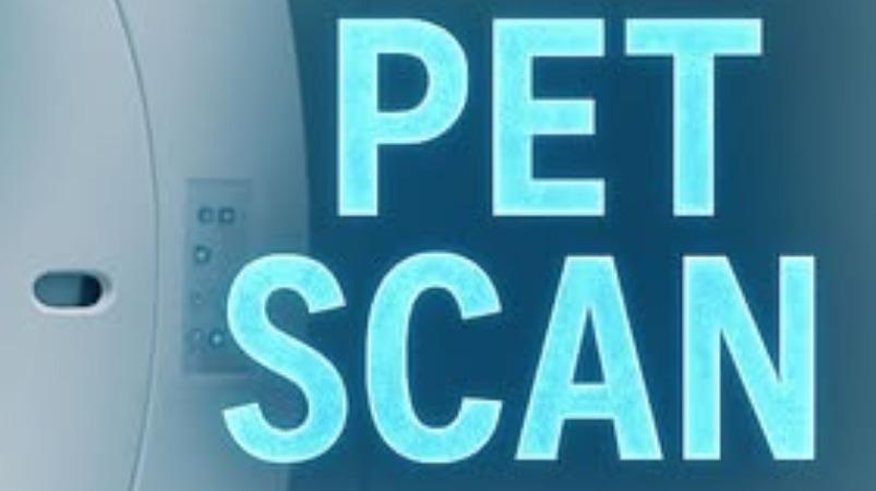 positron-emission-tomography-scan