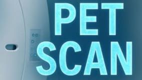 positron-emission-tomography-scan