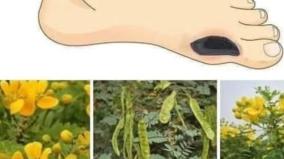 sugar-patient-health-tips