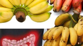 banana-health-tips-motion-problem