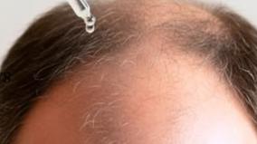 hair-grow-taiwan-scientific