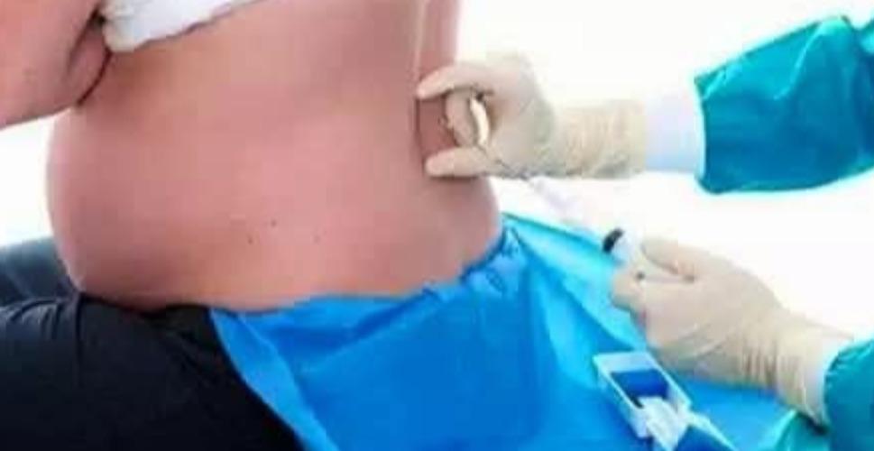 epidural-anesthesia-health-tips